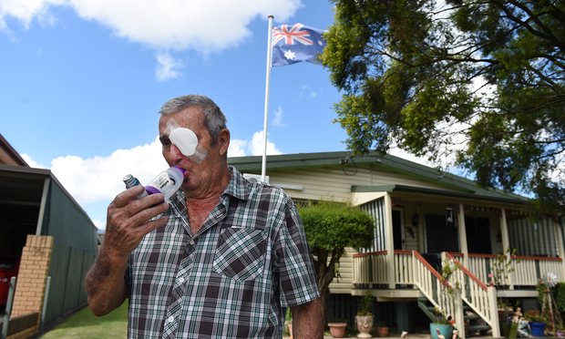 Percy Verrall, First Victim Of Black Lung In Australia